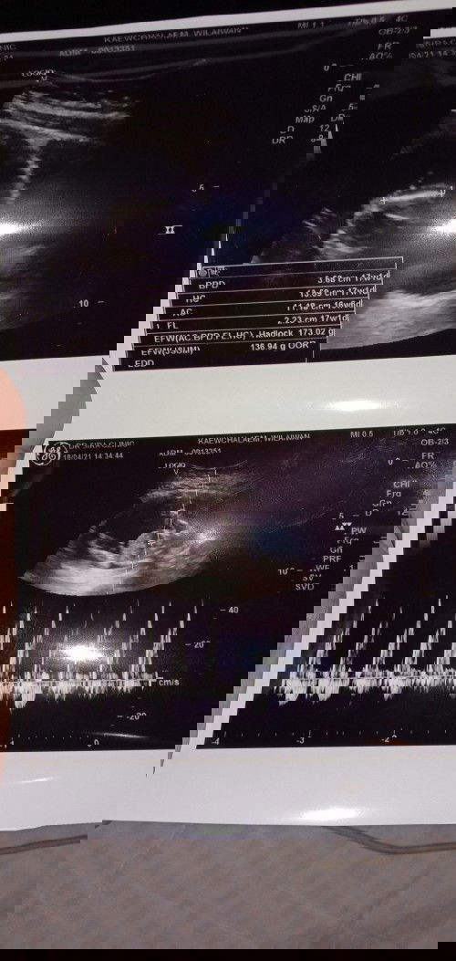 ขอถามแม่ๆหน่อยค่ะไปซาวมาแต่ดูเพศไม่ชัดแม่ๆพอจะดูอกกไหมจ้าว่า
ญ รึ ช ตื่นเต้นสุดๆท้องแรกค่ะ