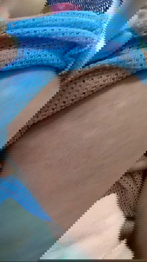 ด่างๆดวงๆขาวๆ