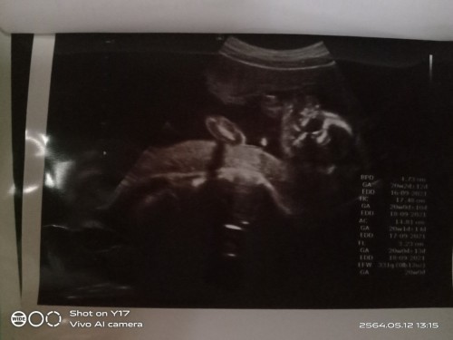 อยากรู้ว่าเพศ ญ รึ ช