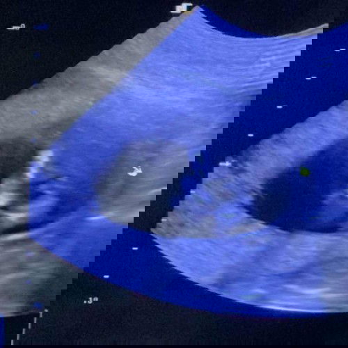 ขอสอบถามหน่อยค่ะ