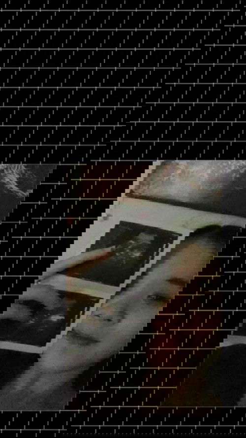 ท้องได้5เดือนแล้วแต่ยังไม่รู้เพศเลย