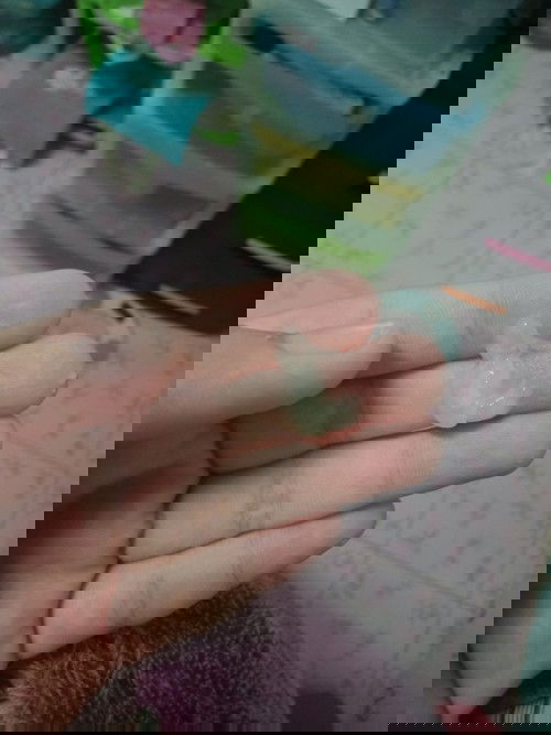 แบบนี้ใช่มูกใสมั้ย