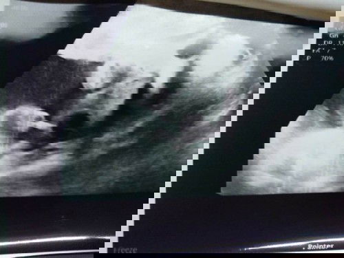 มาทายกันค่ะแม่ๆ