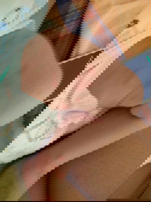 ขอสอบถามหน่อยค่ะน้องผื่นขึ้นแบบนี้เป็นอะไรมั้ยค่ะเป็นแค่ตรงแขนกับขาแล้วก็ตรงใต้คางค่ะ#ขอคำแนะนำหน่อย