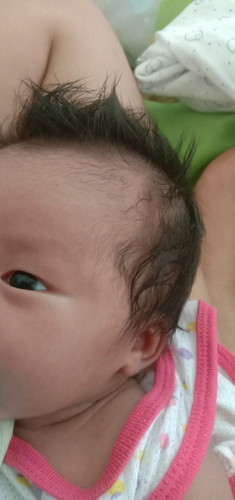 มีแม่ๆบ้านไหนไม่โกนผมไฟให้ลูกมั้ยคะ