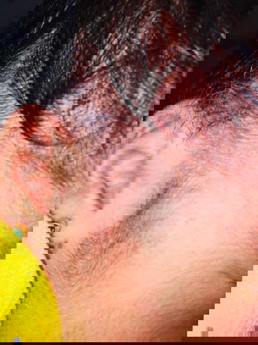 Tnong ko lang po kung ano yung mga butlg ni bby na prang may tubg nag wo2ry npo ako 1week npo si bby salamat sa sgot po.