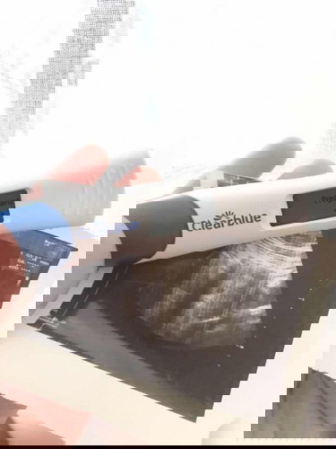 Ikut apps kandungan dah masuk 8week tapi bila scan jadi 3week