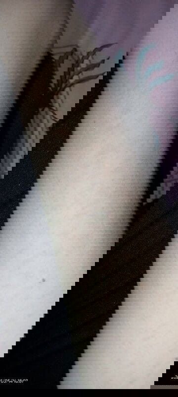 Bintik bintik merah pada tangan