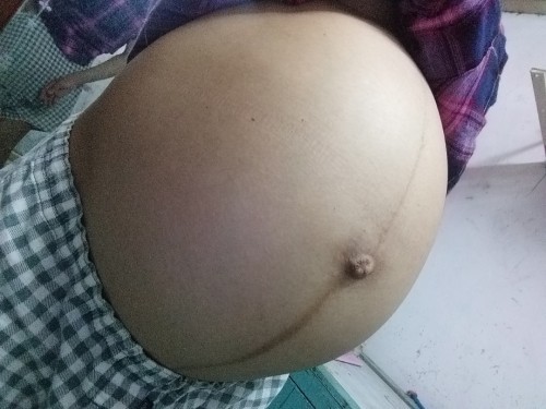 36 tuần bụng như này đã tụt chưa mấy Mom? Đi bộ xíu là căng cứng bụng dưới vậy có ảnh hưởng bé ko?