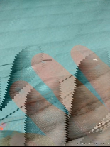 มีมูกใสไหล