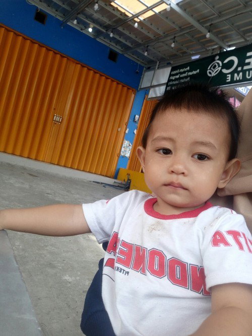 Muka anak ada bercak putih2