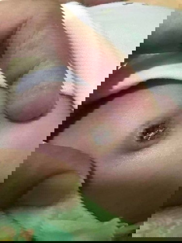 ทำความสะอาดสะดือหลังจี้