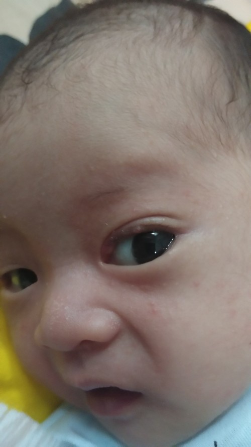 Bayi mata bintit