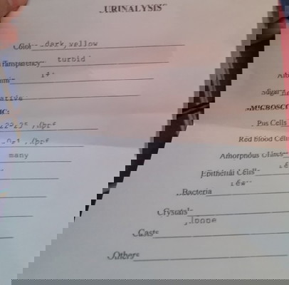 hindi mawala walang UTI