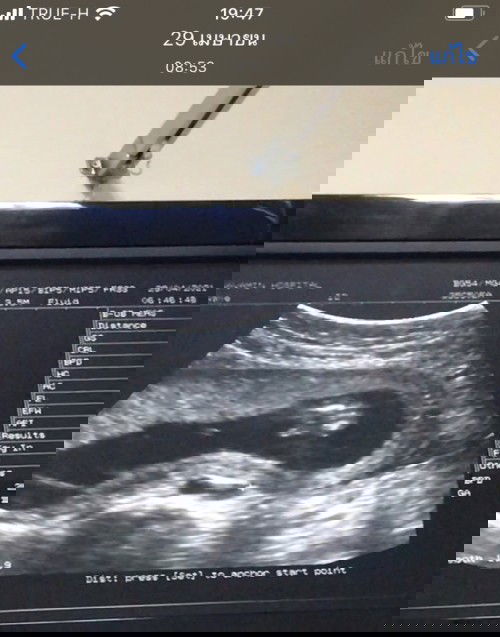 ปรึกษาแม่ๆคะ คิดว่า ผญ.หรือ ผช. คะ  ขอความคิดเห็น กราบขอบพระคุณล่วงหน้าคะ