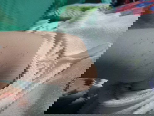 anu po kaya itong sa braso ni baby.woried lang po ako😢