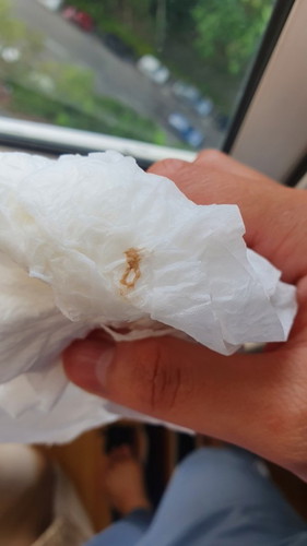 Normal ke pregnant 6w 3d ada ni sewaktu di toilet