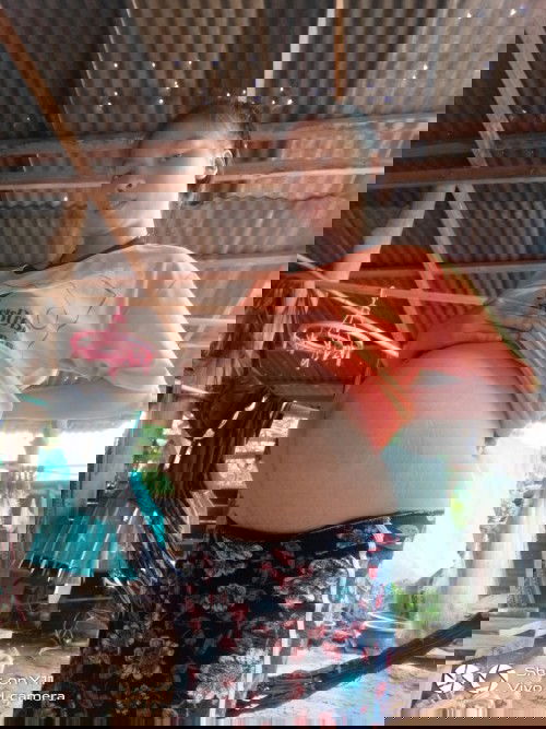 ใครเป็นเหมือนกันบ้างเริ่มมีอาการเจ็บหัวหน่าว เจ็บหว่างขารามไปถึงจิมิ ปวดมากต้องทำยังไงคะ