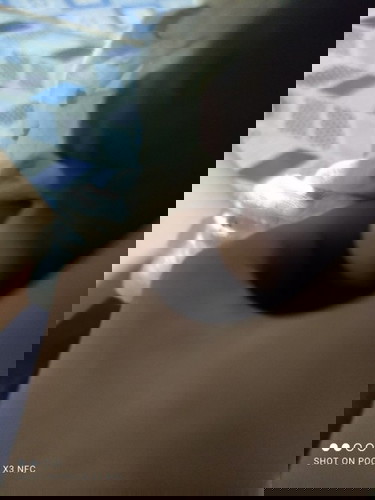 Breastlump
