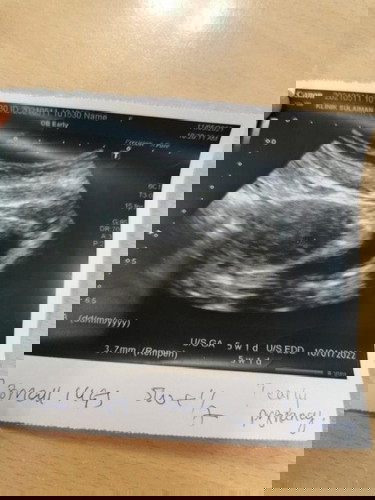 CBD Positif selepas 3 hari Not Pregnant