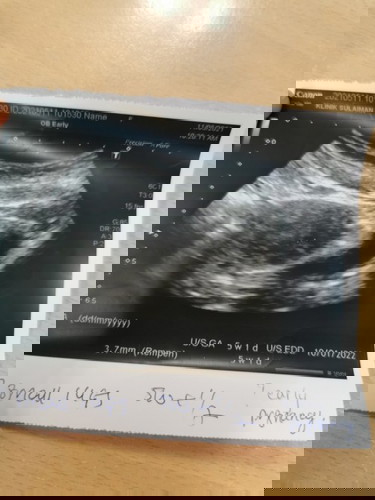 CBD RESULT POSITIF 1-2, 3 HARI KEMUDIAN CBD NOT PREGNANT