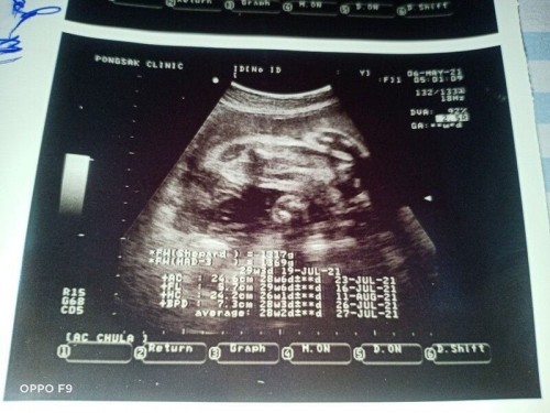 แม่ๆช่วยดูให้หน่อยค่ะ