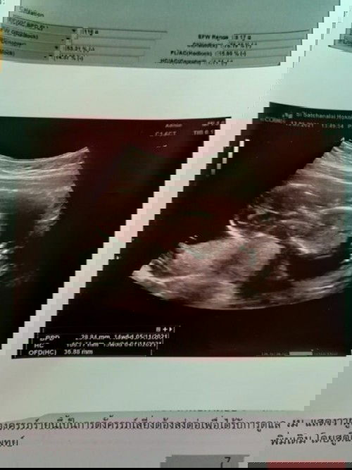 ถามแม่ๆที่รู้หน่อยคะ