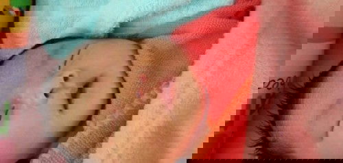 ผ่าคลอดมาได้10วัน น้องนอนอ้าปากไอและจามบ้างน้องมีอาการแบบนี้ติดจากแม่รึป่าวค่ะแม่มีอาการไอทำยังไงค่ะ