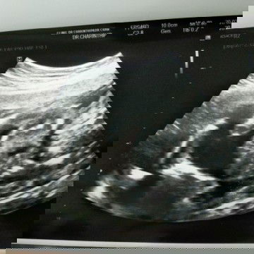 ทีมกรกฎาคม