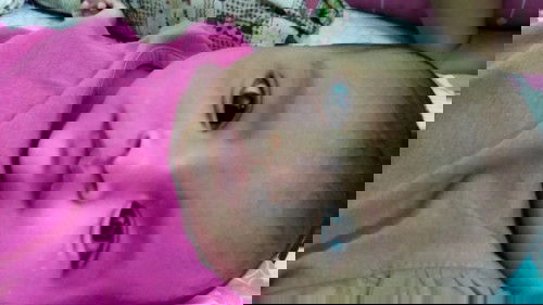 Kulit putih putih kena bekas susu