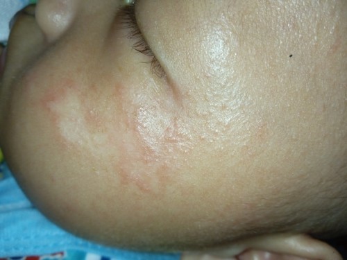 หน้าน้องเป็นอะไรค่ะ