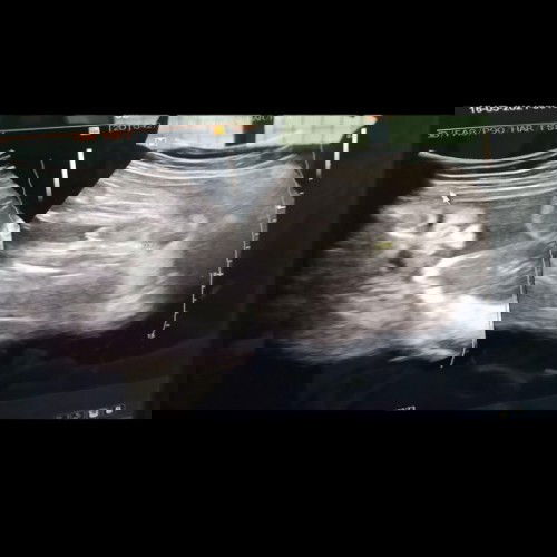 อัลตร้าซาวด์ 27w