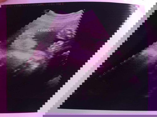 เพศ-น้ำหนักน้อง