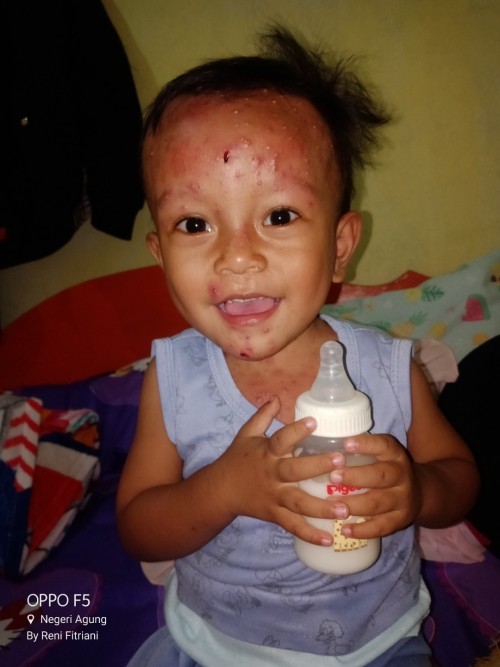 Anak usia 2 tahun 1 bulan