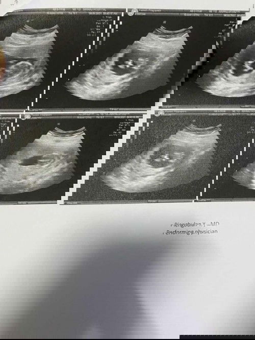 อยากให้แม่ๆช่วยดูเพศ