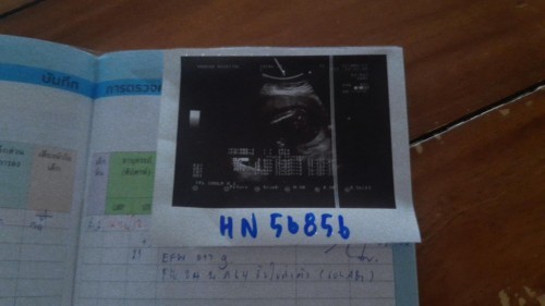 ฝากครรภ์ลูกคนแรก🥰