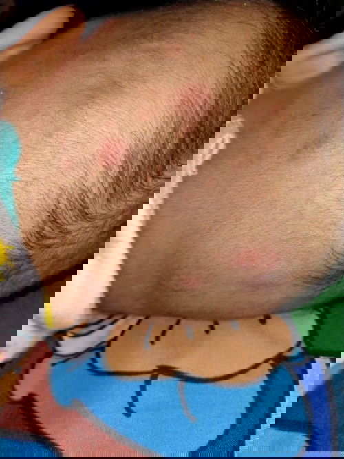 Seperti bentol di kepala