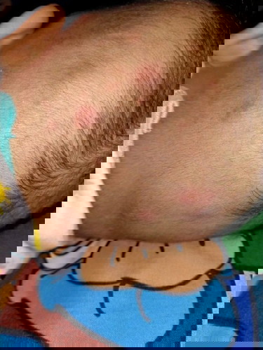 Seperti bentol di kepala