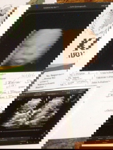 Usiakandungan24minggu...