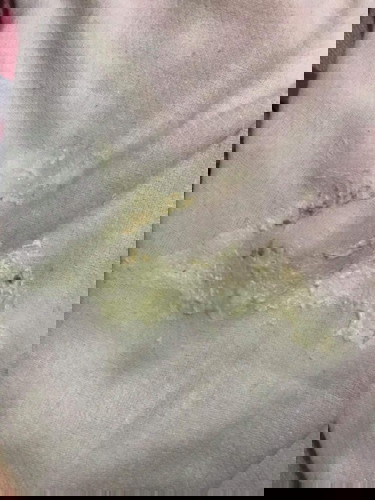 Spit up of 2 months old baby