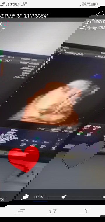 คุณแม่บ้านนี้ 38w2d กำหนดคลอด 1 มิ.ย.64 ตอนนี้น้องน้ำหนัก 2850 กรัม แล้ว