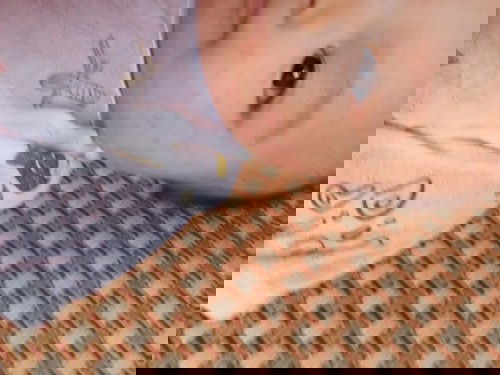 Sốt phát ban.
.,........