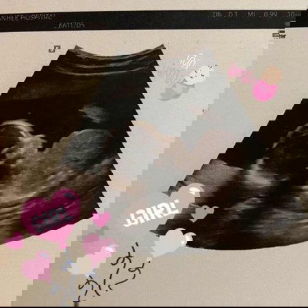 แม่ๆบ้านไหนกำหนดคลอดตุลาบ้างคะ