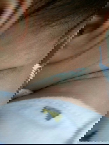 Các m cho e hỏi như này là bị làm sao ạ có m nào biết chỉ e với ạ