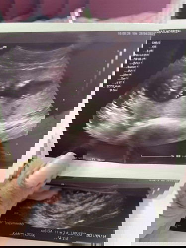 บ้านไหนซาวดูเพศแล้วบ้าง