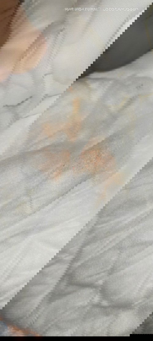 Bayi 6 bulan pipis di sertai darah