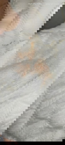 Bayi 6 bulan pipis di sertai darah