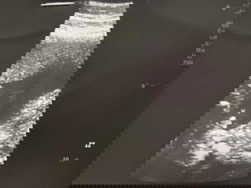 เด็กน้อย20Week