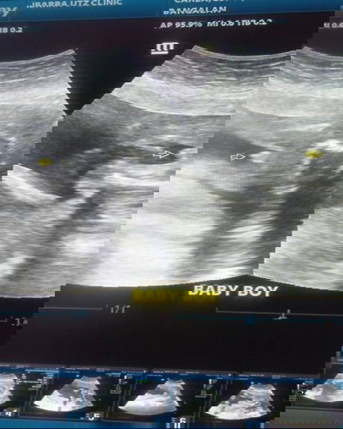 Its a boy..😇 again..