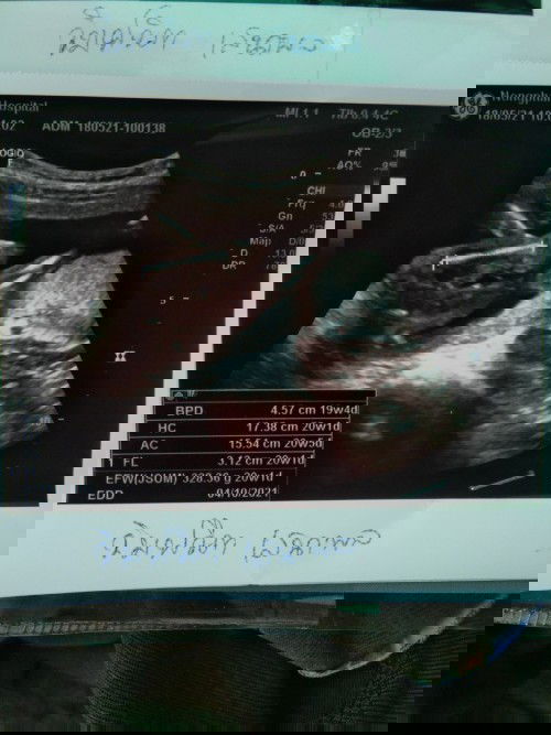 แม่ๆคะช่วยดูหน่อยค่ะ เพศอะไรตรงไหนคืออะไร